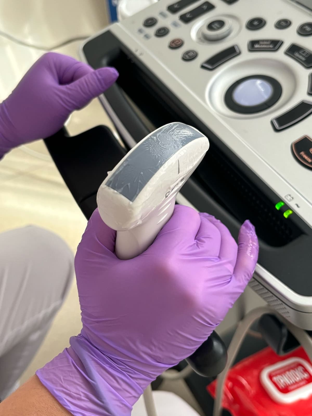 аппарат узи